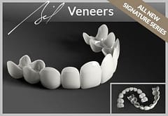 BILVeneers