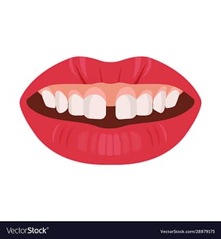 gap teeth