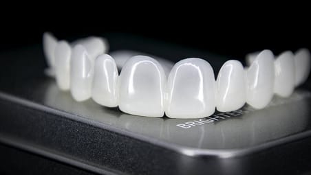 7D-Straight-On.jpg how long do veneers last