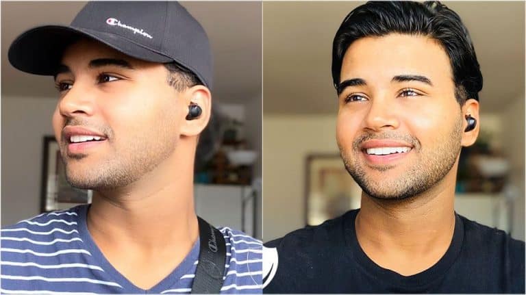 BilVeneers client Ishu D