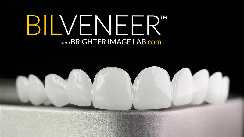 Bilveneer-from-brighter-image-lab_image