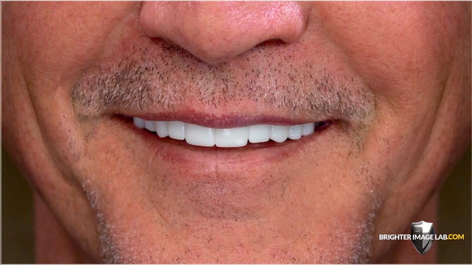 Bil_CloseUp-WEB