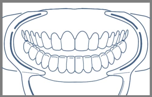 teethshowing