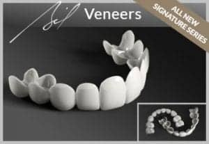 Order BilVeneers de Brighter Image Lab