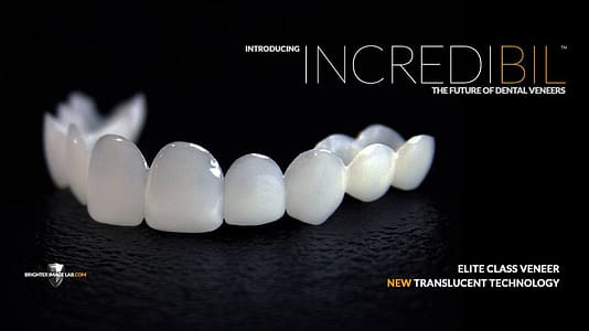 incredibil-veneers-2.jpg
