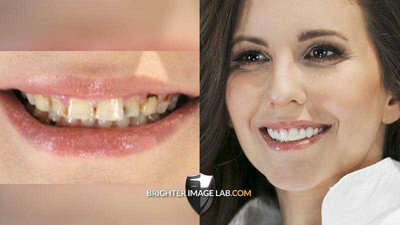 NoreenBeforeAfter-1-1.jpg