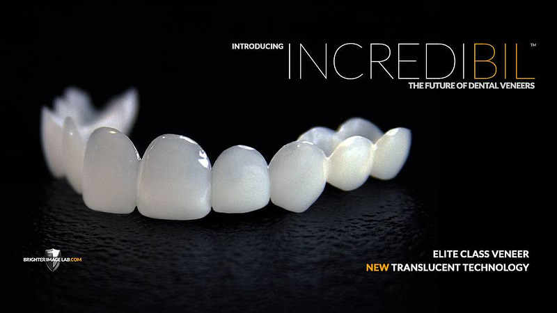 incredibil-veneers-2.jpg