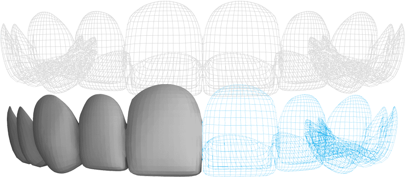 wireveneer.png