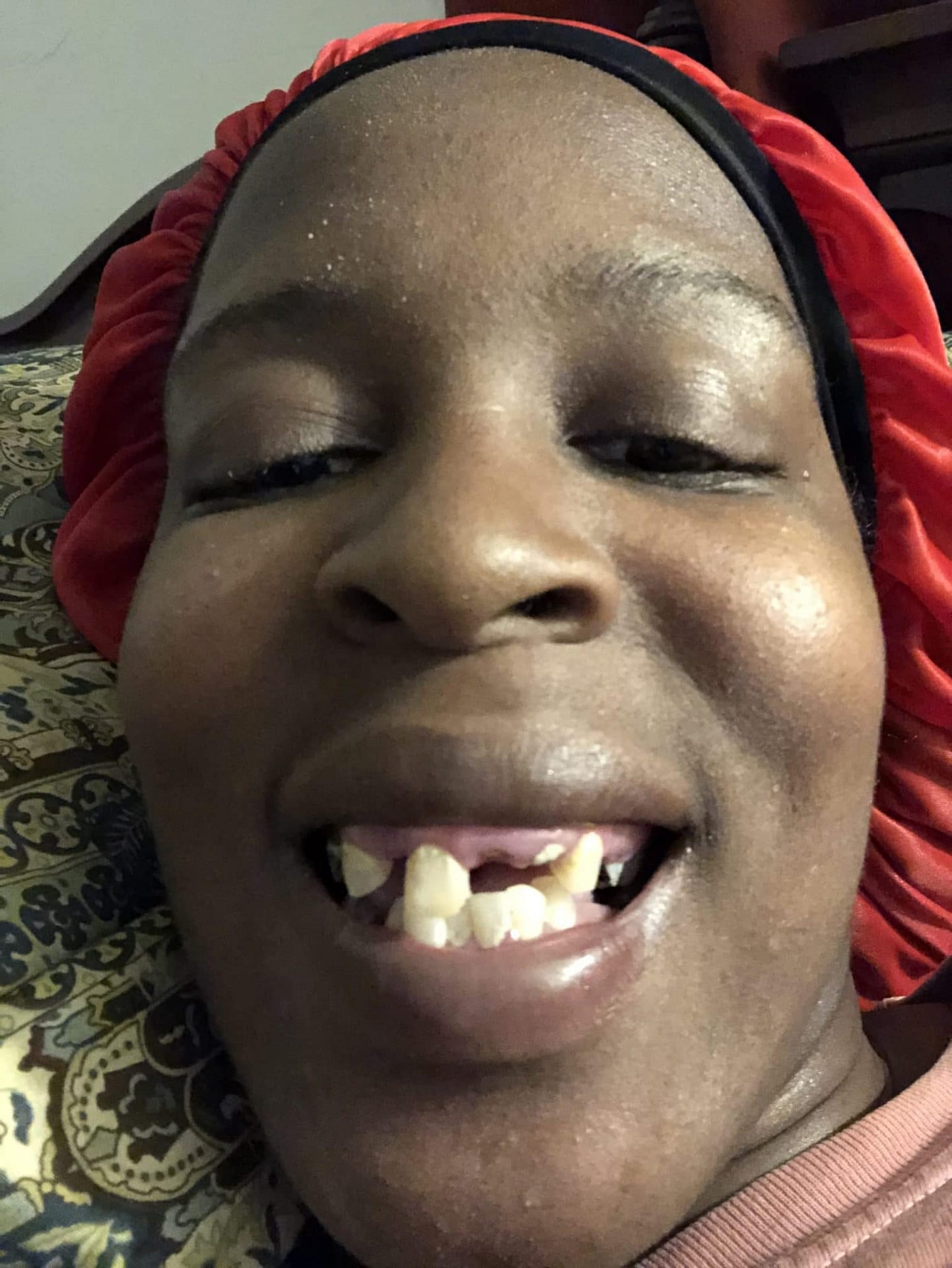 missing teeth