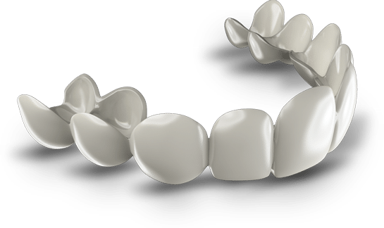 porcelain veneers