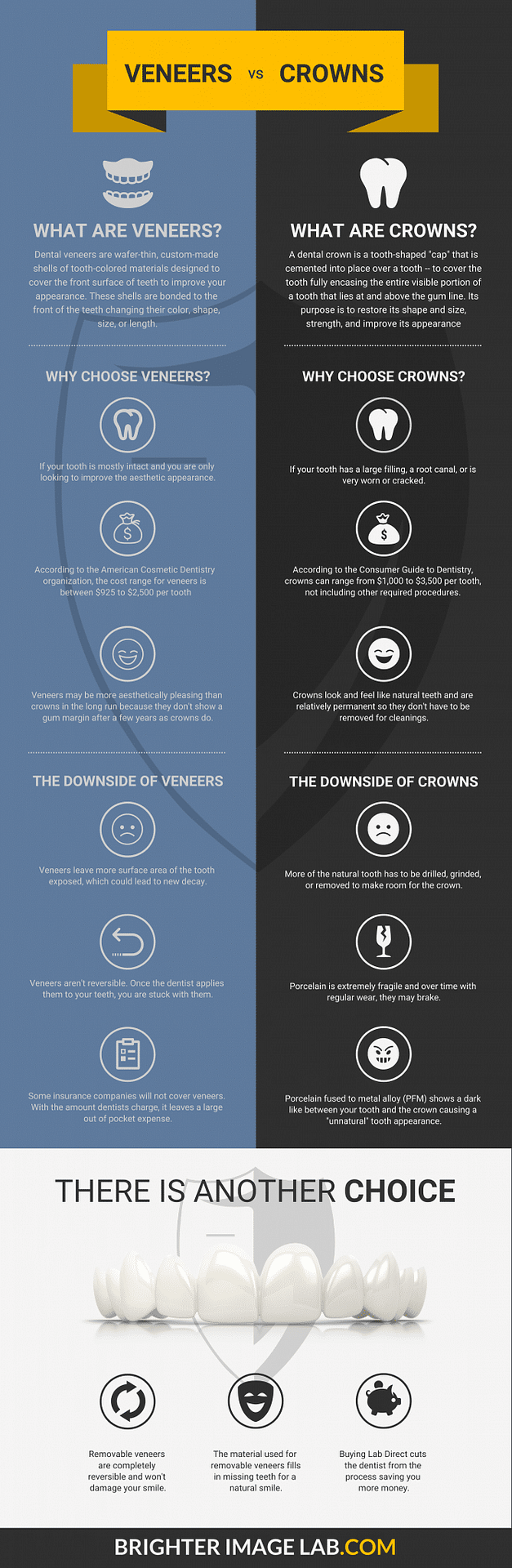 Placages vs couronnes