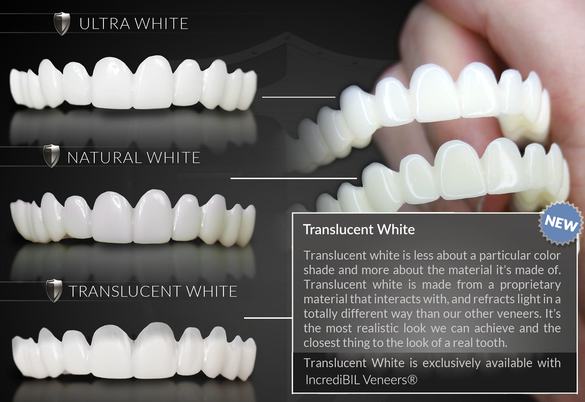 Exclusive Smile Shades by Brighter Image Lab