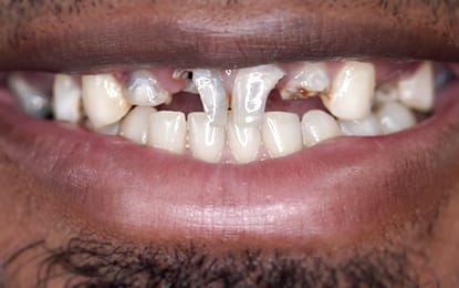 Xavier_SliderBefore Xavier_SliderBefore