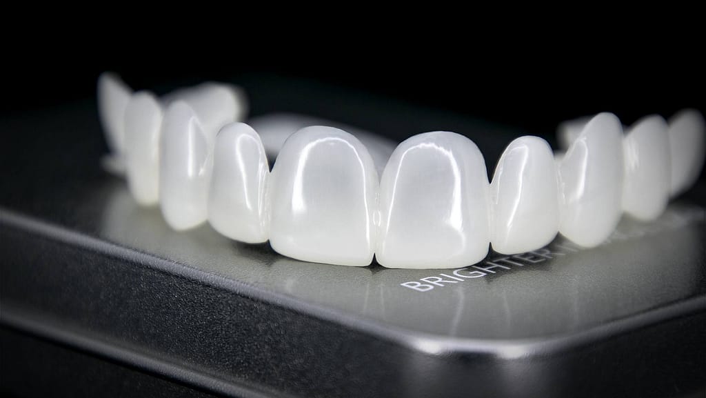 how long do veneers last