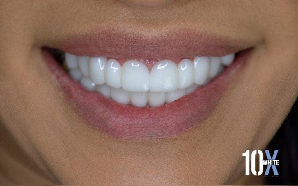 ana-10x-after-1024x641