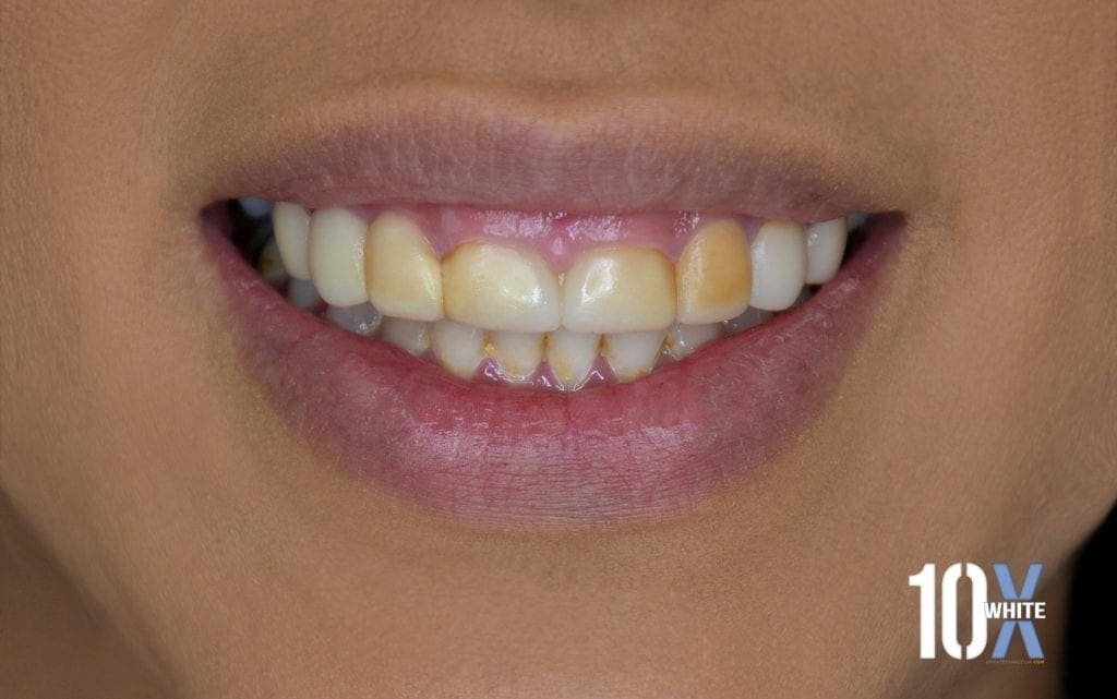 ana-10x-before-1024x641