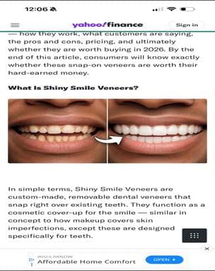 Shiny Smile Veneers lawsuit - press releases