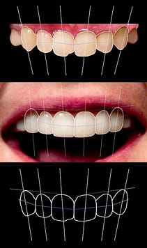 Brighter Image Lab - The Cost of Dental Work Leaves Most with No Real Choice