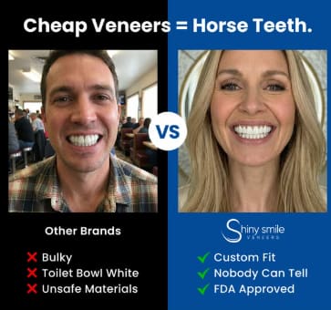 Example from Shiny Smile’s social media ads that appear digitally altered by AI.