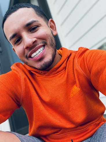 smile transformation smile transformation