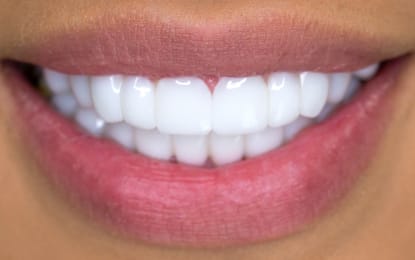 Ana-after-Slider Ana-after-Slider