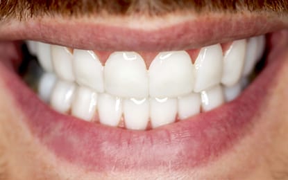 Slider-AJ-After Slider-AJ-After