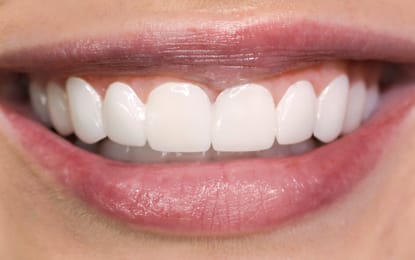 Slider-Lily-After Slider-Lily-After