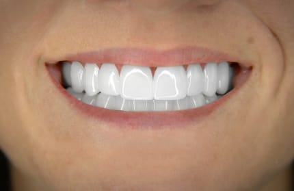 10x-white-heather-afters-close-430x279_c