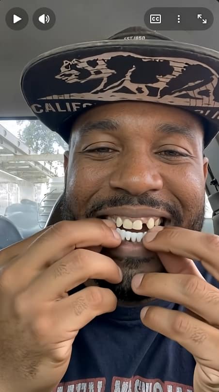 AI Faceswapped version used in Shiny Smile Veneers' advertising