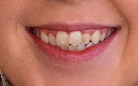 whitney-co-before-e1574713247893 whitney-co-before-e1574713247893