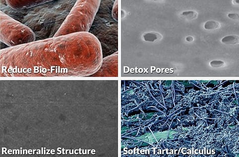 Our Detox Serum reduces bio-film, detoxes pores, remineralizes structure, and softens tartar/calculus