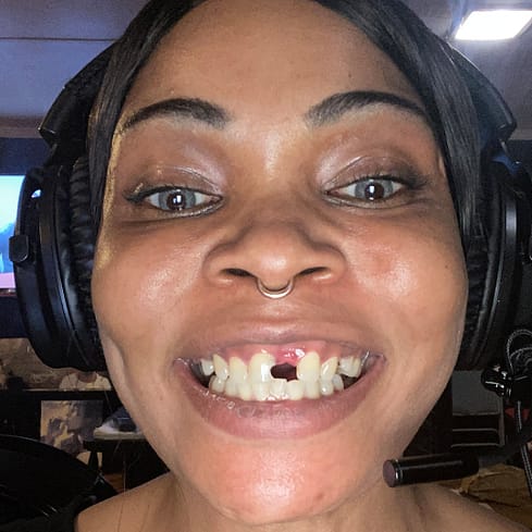 smile transformation smile transformation