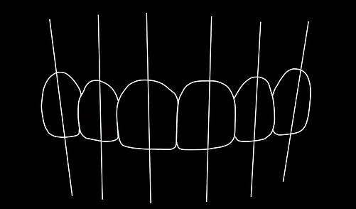 Upload your photos for a free consultation