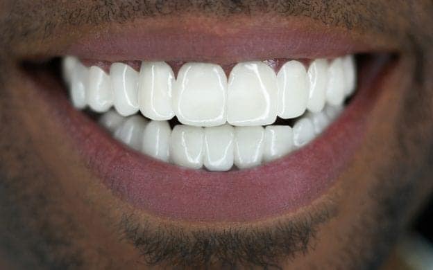 Reggie-afters-624×390 Reggie-afters-624x390