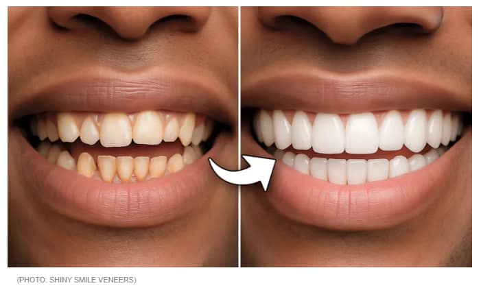 AI Generated 'before and after' image used by Shiny Smile Veneers
