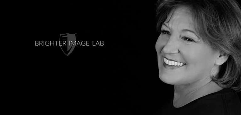 bilveneers-client-jill-d-right