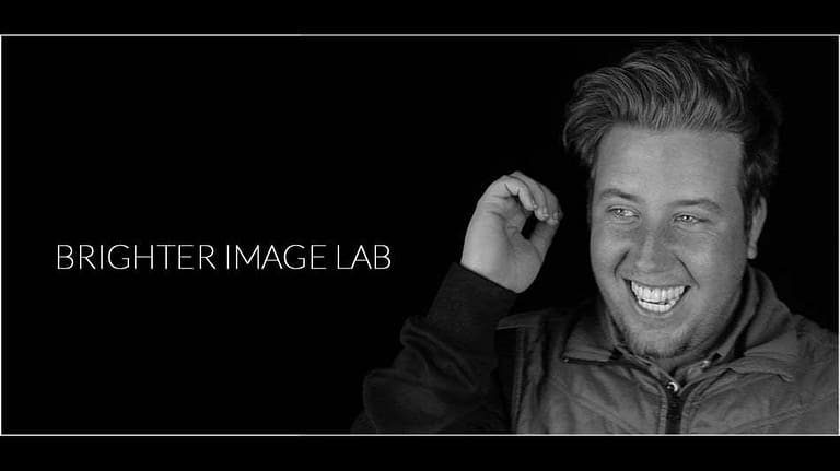 bilveneers-client-dougie-v-center