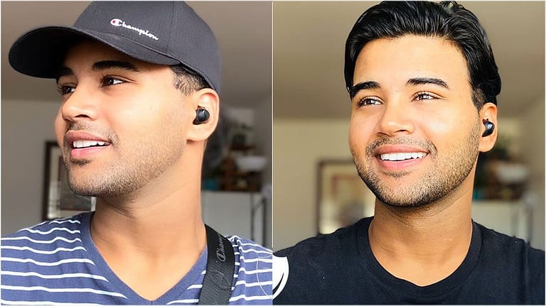 BilVeneers client Ishu D