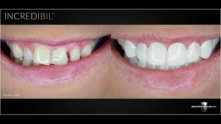 incredibil-client-dee-dee-closeup