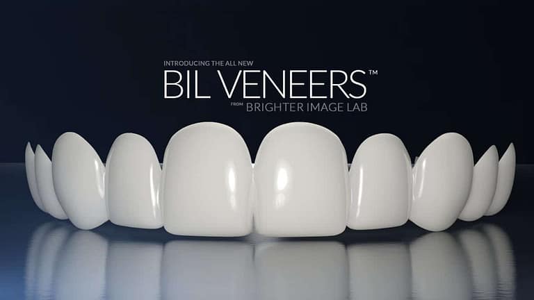 bilveneers-product-shot