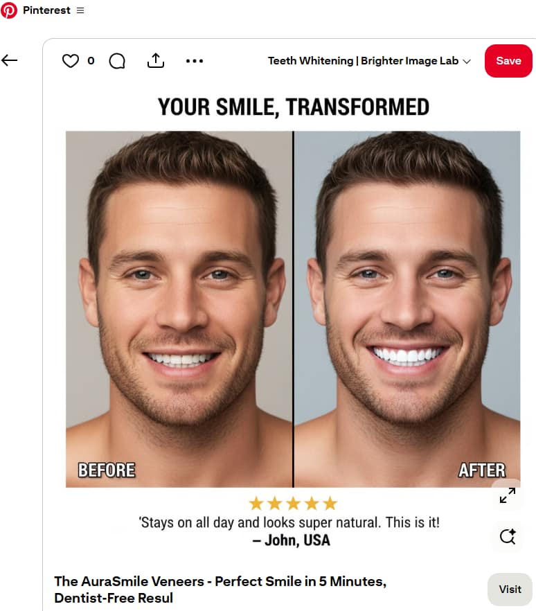 Pinterest before-and-after snap-on veneer advertisement featuring enhanced smile transformation comparison.