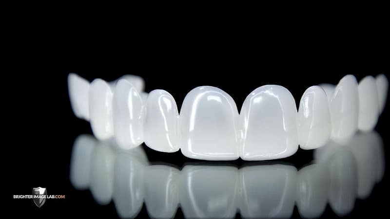 Removable Veneers by Brighter Image Lab