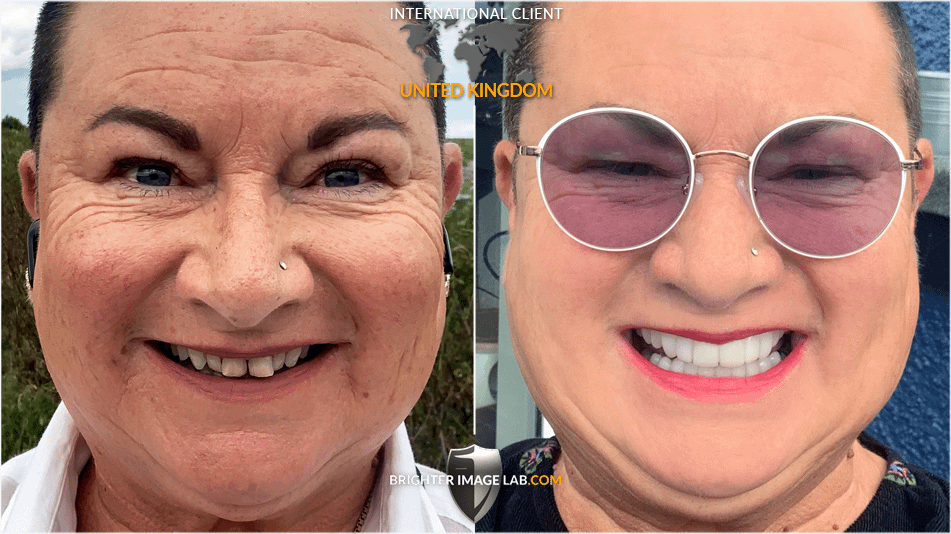 UK-LorraineWilson_WEB-BA