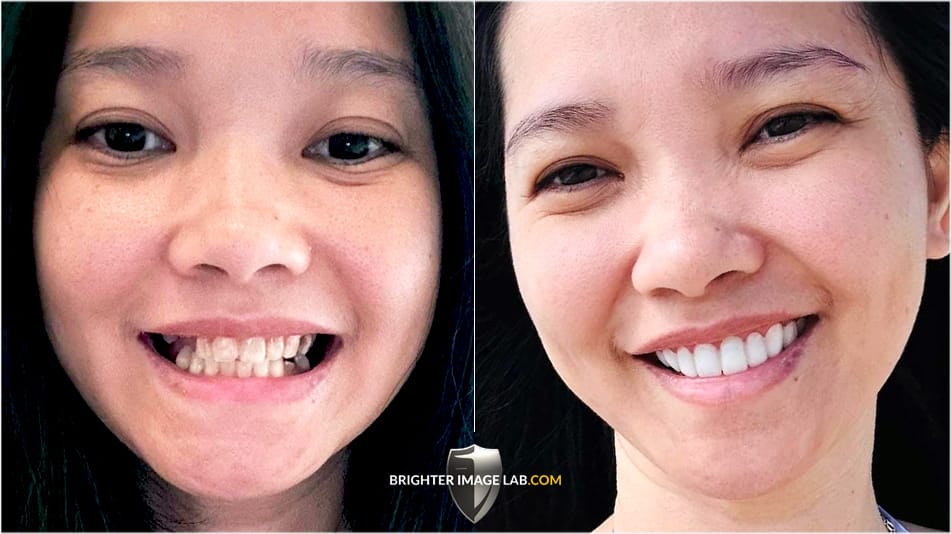 MelchinMorimoto_WEB-B-A