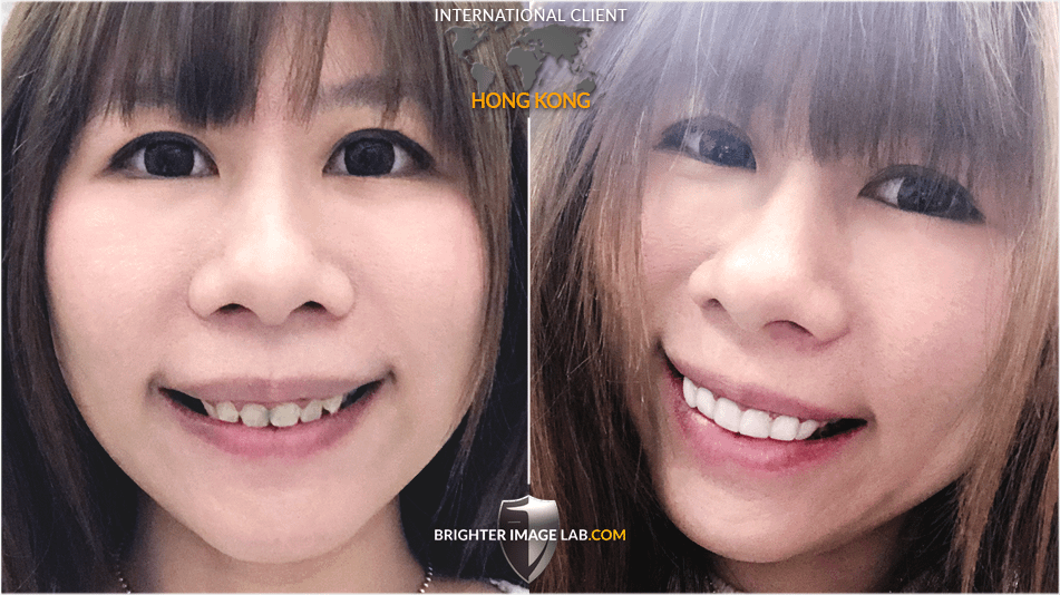 HongKong-WEB-BA