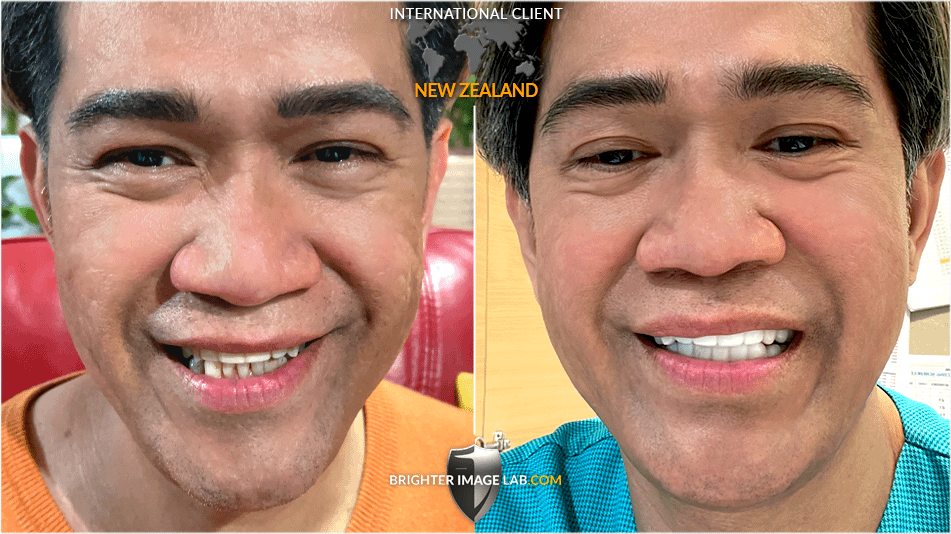NZ-EdgardoLozano-WEB-BA