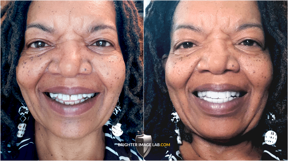 AngelaDMassey_WEB-BA