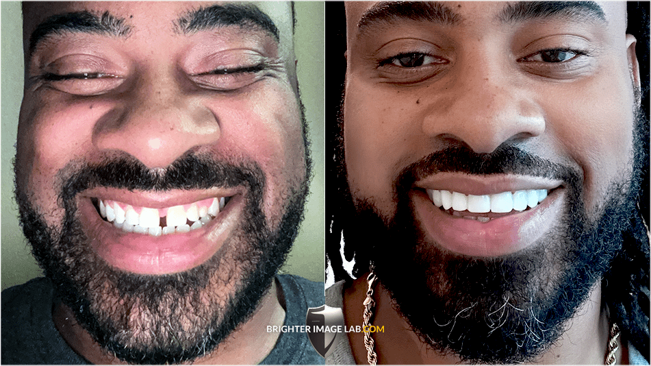 WalterSPatterson_WEB-BA