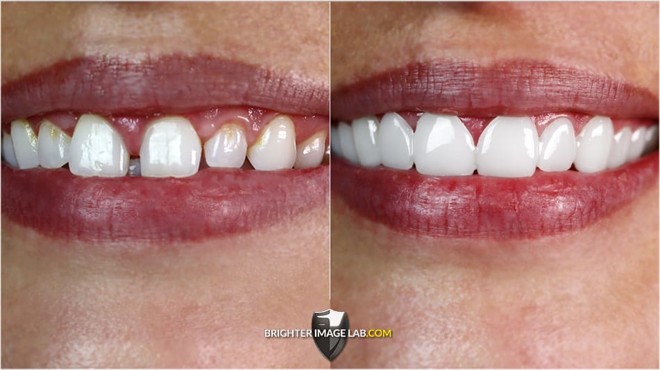 ChristenWeb_CloseUpBA