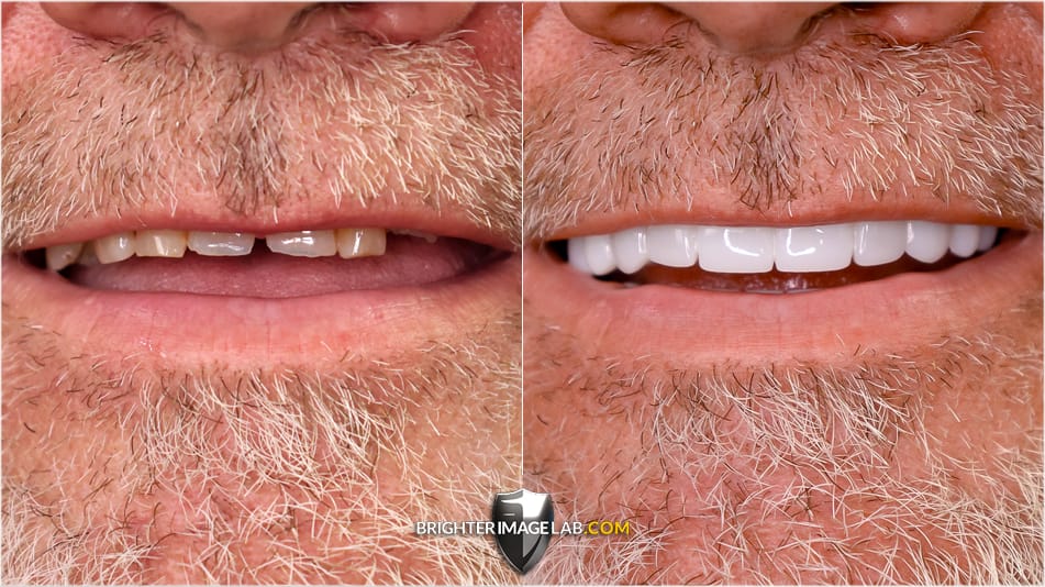 Tommy_CloseUp-WEB